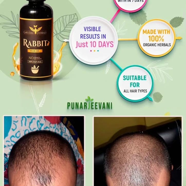 Garuda Rabbit Herbal Hair Oil(5.0 ⭐⭐⭐⭐⭐ 18,345 REVIEWS) Globally