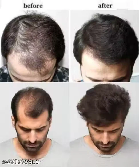 Garuda Rabbit Herbal Hair Oil(5.0 ⭐⭐⭐⭐⭐ 18,345 REVIEWS) Globally