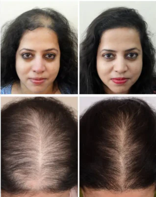 Garuda Rabbit Herbal Hair Oil(5.0 ⭐⭐⭐⭐⭐ 18,345 REVIEWS) Globally