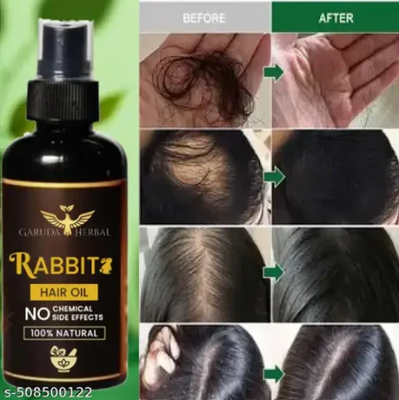 Garuda Rabbit Herbal Hair Oil(5.0 ⭐⭐⭐⭐⭐ 18,345 REVIEWS) Globally
